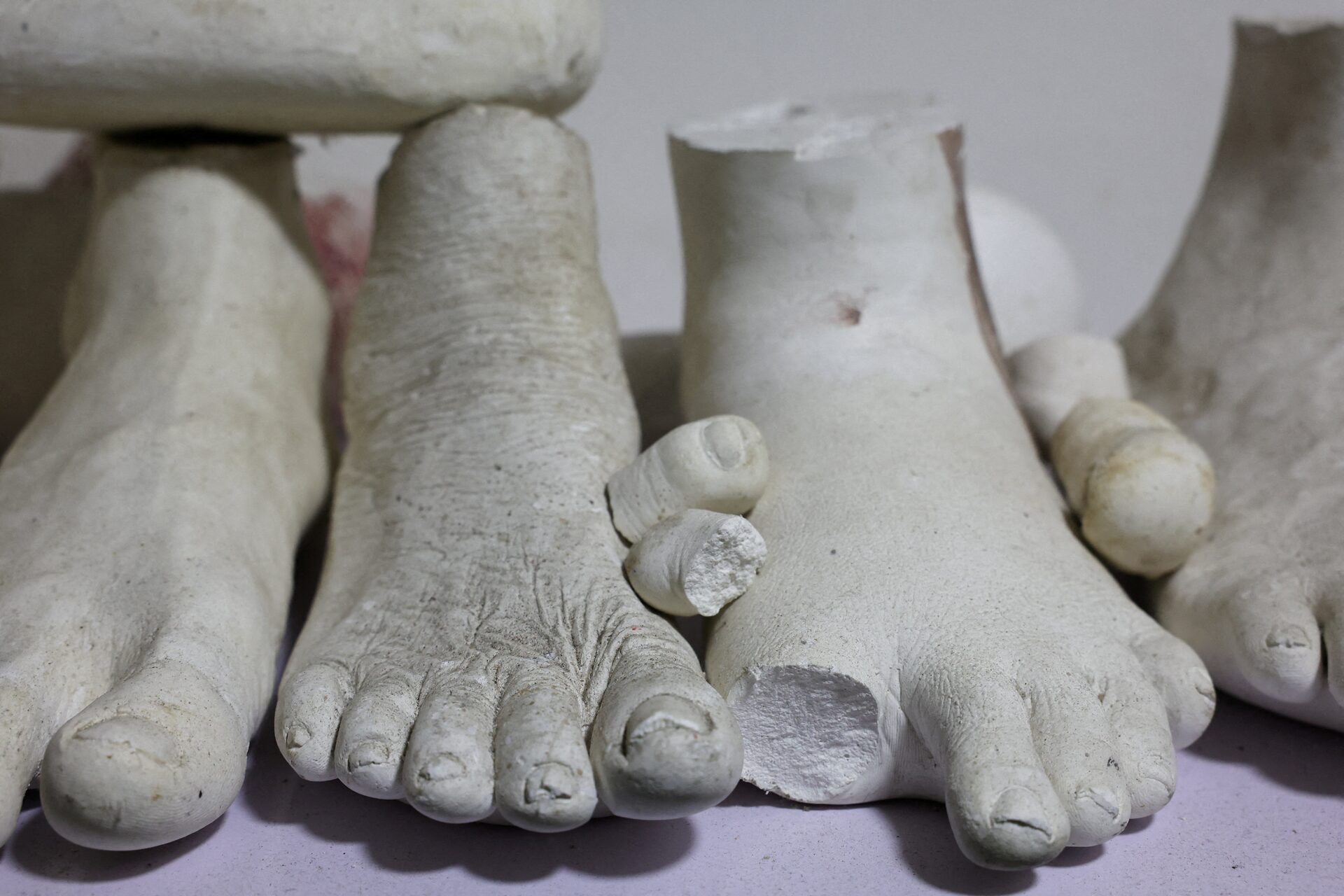 Prosthetic molds at Immortal Cosmetic Art laboratory in Uyo, Akwa Ibom state, Nigeria, August 15, 2025. REUTERS/Sodiq Adelakun